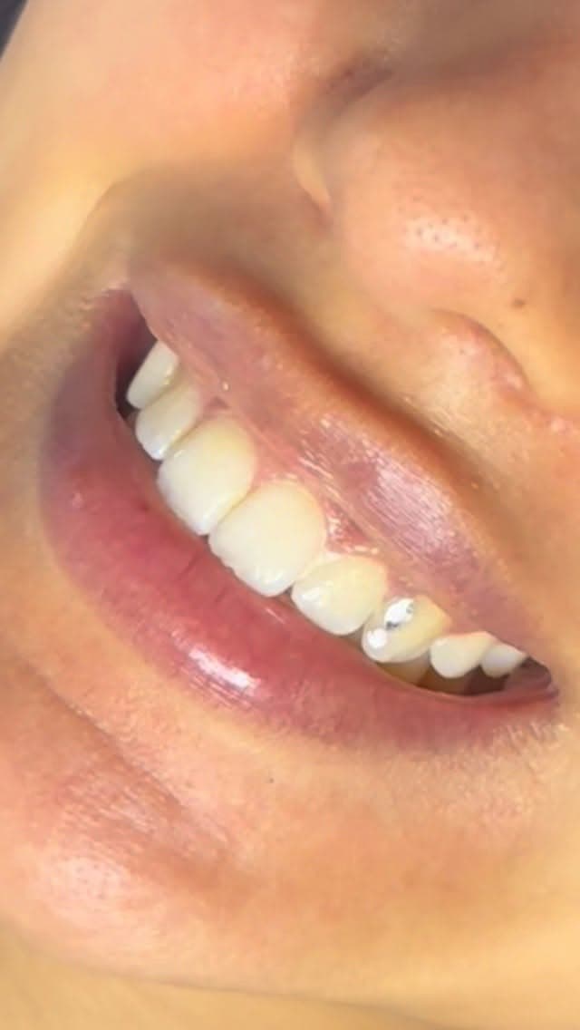 Tooth gem close-up van Lash Affair